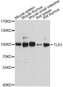 Western blot - TLR1 Polyclonal Antibody (144-00997)