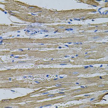 Immunohistochemistry - EIF1AY antibody (144-04270)