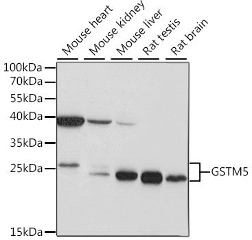 Western blot - GSTM5 antibody (144-015677)
