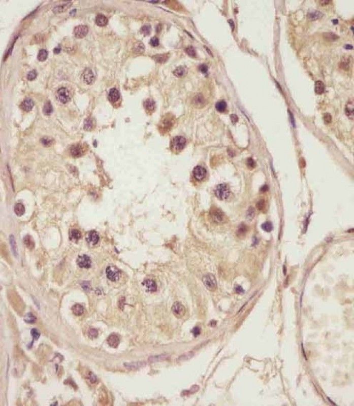 IHC-P