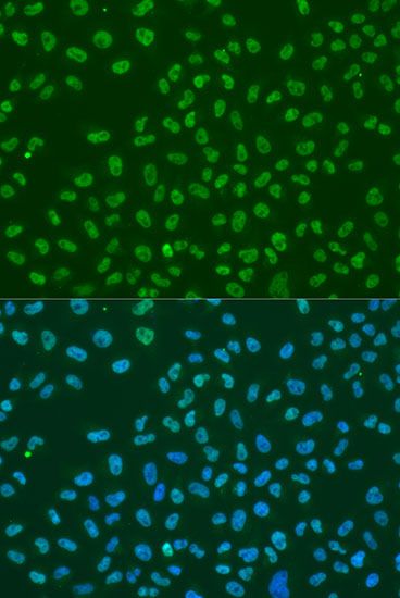 Immunohistochemistry - ELAVL1 Polyclonal Antibody (144-61434)