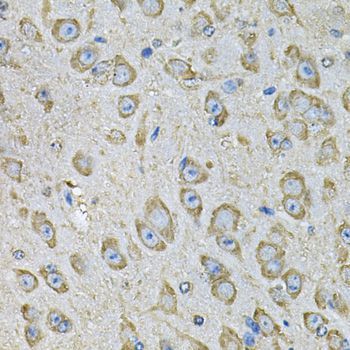 Immunohistochemistry - PDIA6 Antibody (144-07055)