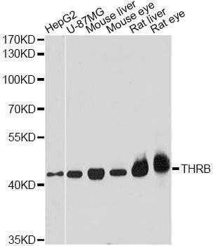 Western blot - THRB antibody (144-01582)
