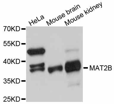 Western blot - MAT2B antibody (144-011608)