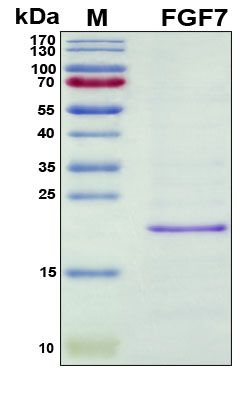 SDS-PAGE