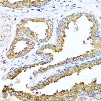 Immunohistochemistry - NCK2 antibody (144-07750)