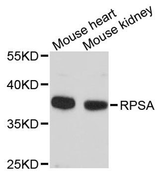 Western blot - RPSA antibody (144-09008)