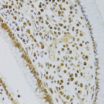 Immunohistochemistry - HEXIM1 Antibody (144-05775)