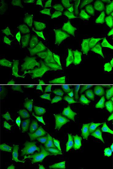 Immunofluorescence - RPS12 antibody (144-05890)