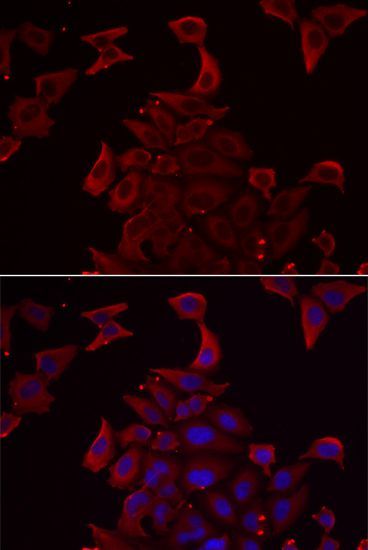 Immunofluorescence - PDHX Polyclonal Antibody (144-06426)
