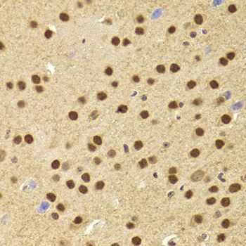 Immunohistochemistry - ANP32A Antibody (144-05768)