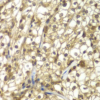 Immunohistochemistry - SULT2B1 antibody (144-07736)