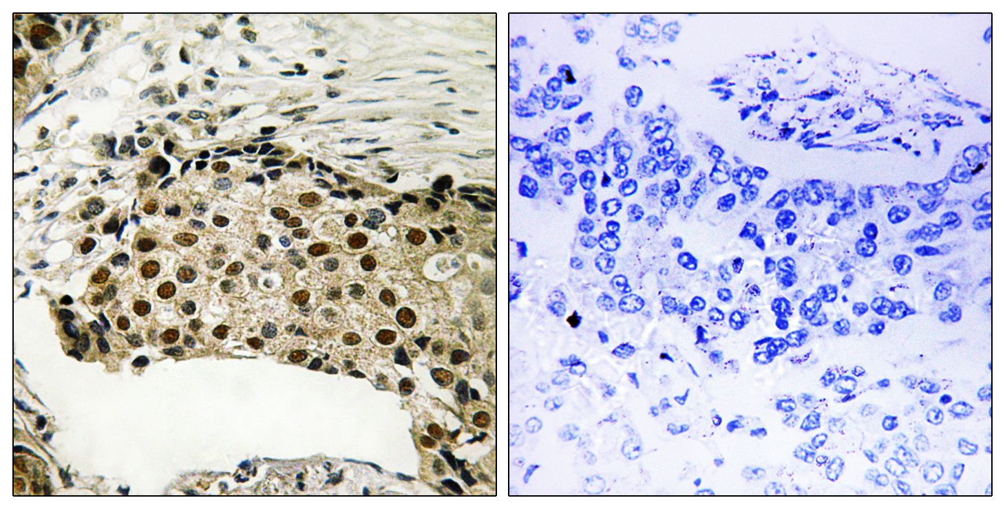 IHC