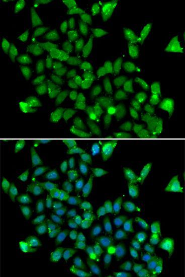 Immunofluorescence - ASPA antibody (144-07271)