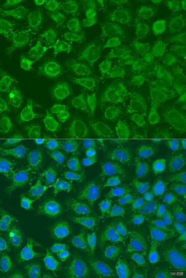 Immunofluorescence - EIF2B1 Polyclonal Antibody (144-07892)