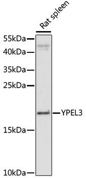 Western blot
