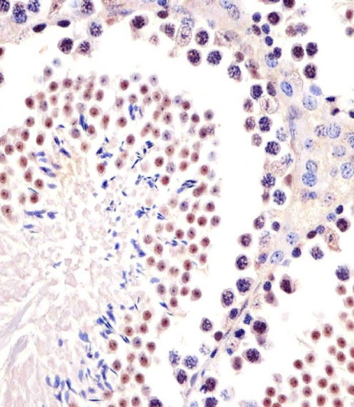 IHC-P