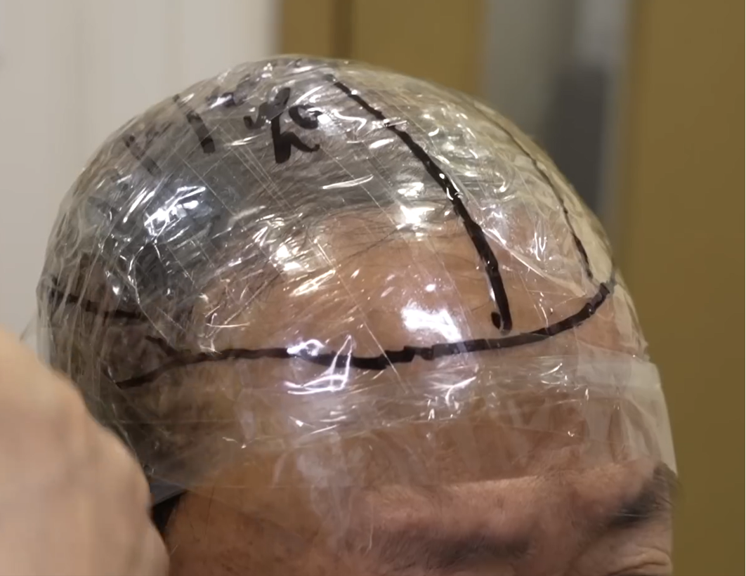 Traditional hair system mold — generic plastic approximation
