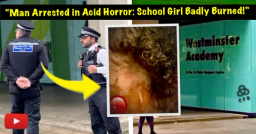 Acid Attack Outside London School Leaves 14-Year-Old Girl With Life-Changing Injuries—Suspect Still at Large!