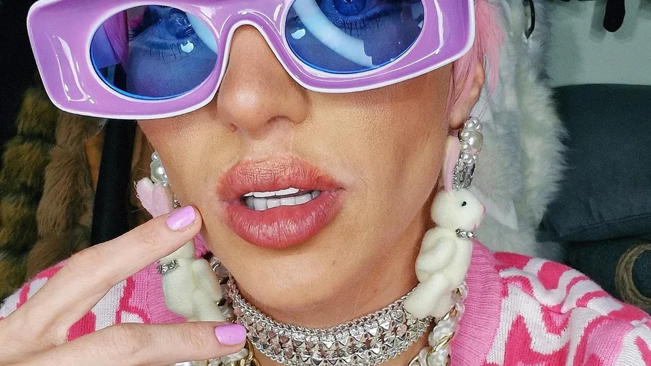 Manusia Barbie Asal Brasil Meninggal di Usia 31 Tahun, Ditemukan Bekas Luka pada Punggung dan Mata Kiri