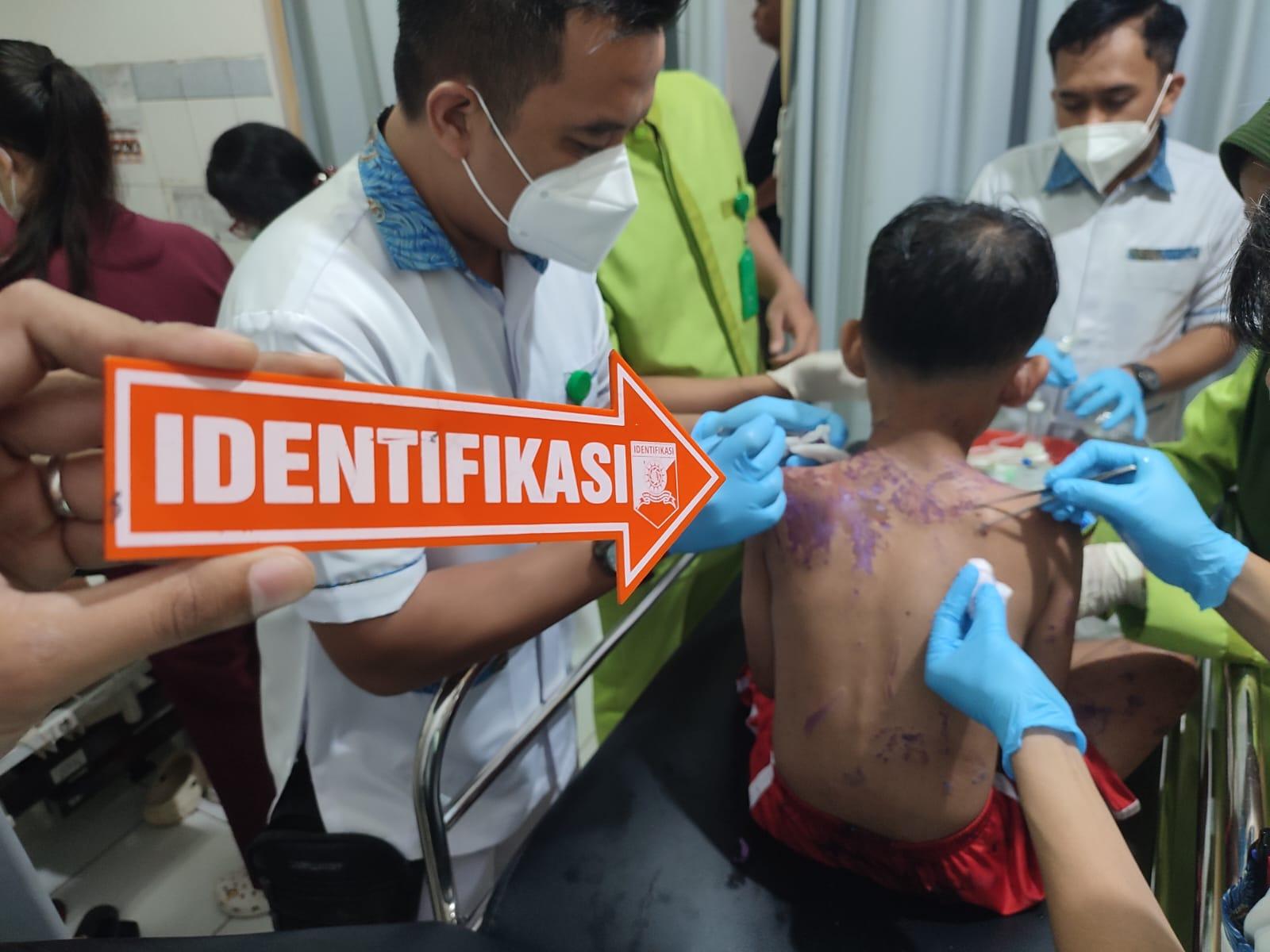 Viral Ibu dan Anak Disiram Air Keras Saat Berkendara, Polisi Buru Pelaku