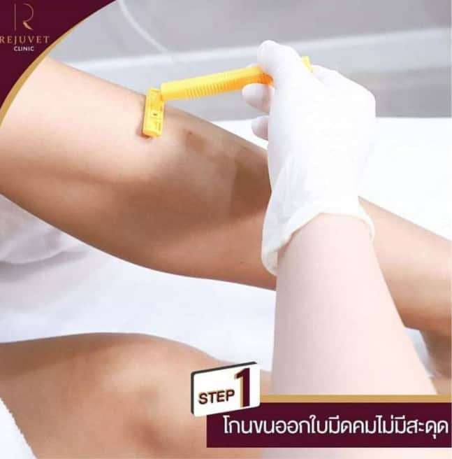 ขั้นตอนการกำจัดขน ผิวใส ด้วยเครื่อง Mediostar Monolith (Diod Laser)