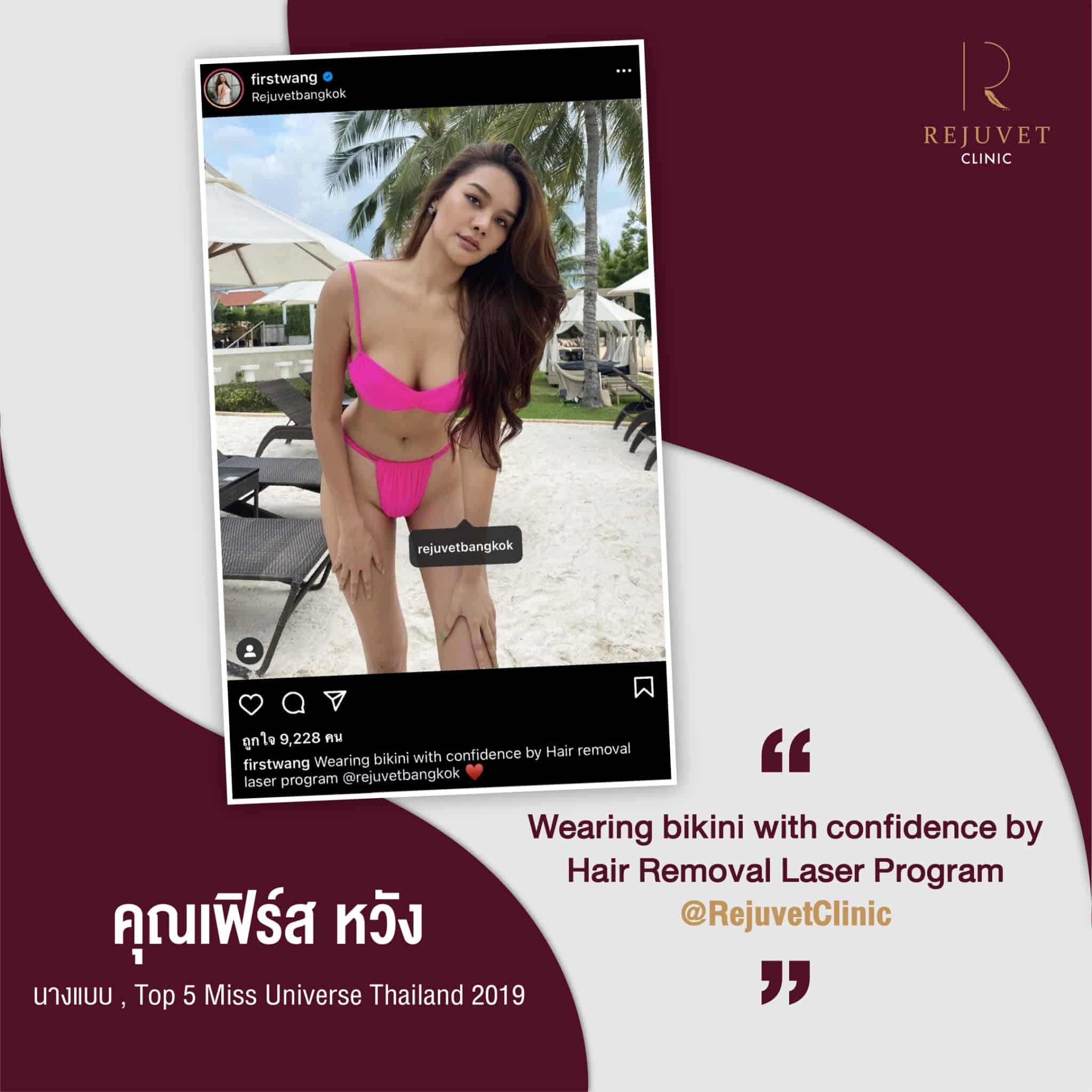 อยากมั่นใจในการใส่บิกินี่แบบ คุณเฟิร์ส หวัง ต้องมาที่ Rejuvet Clinic 