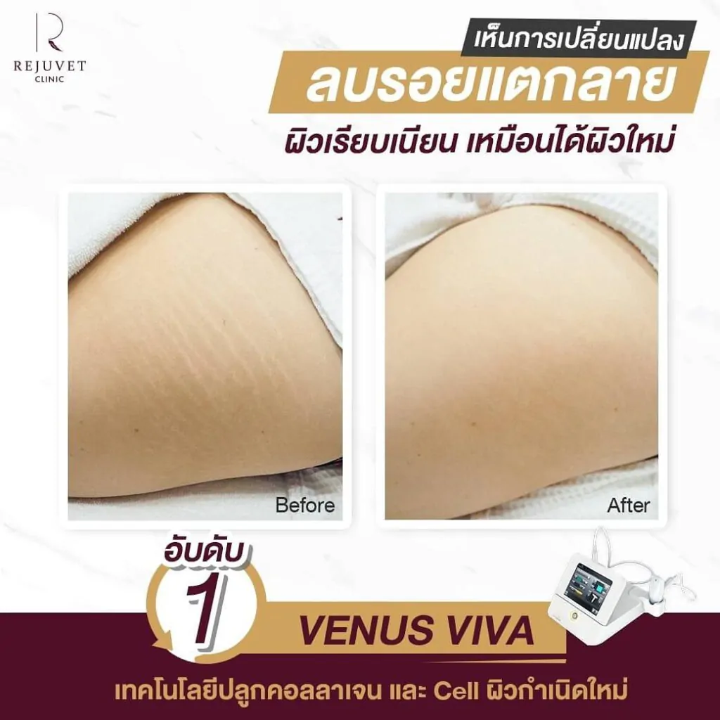 คุณสมบัติของ VENUS VIVA