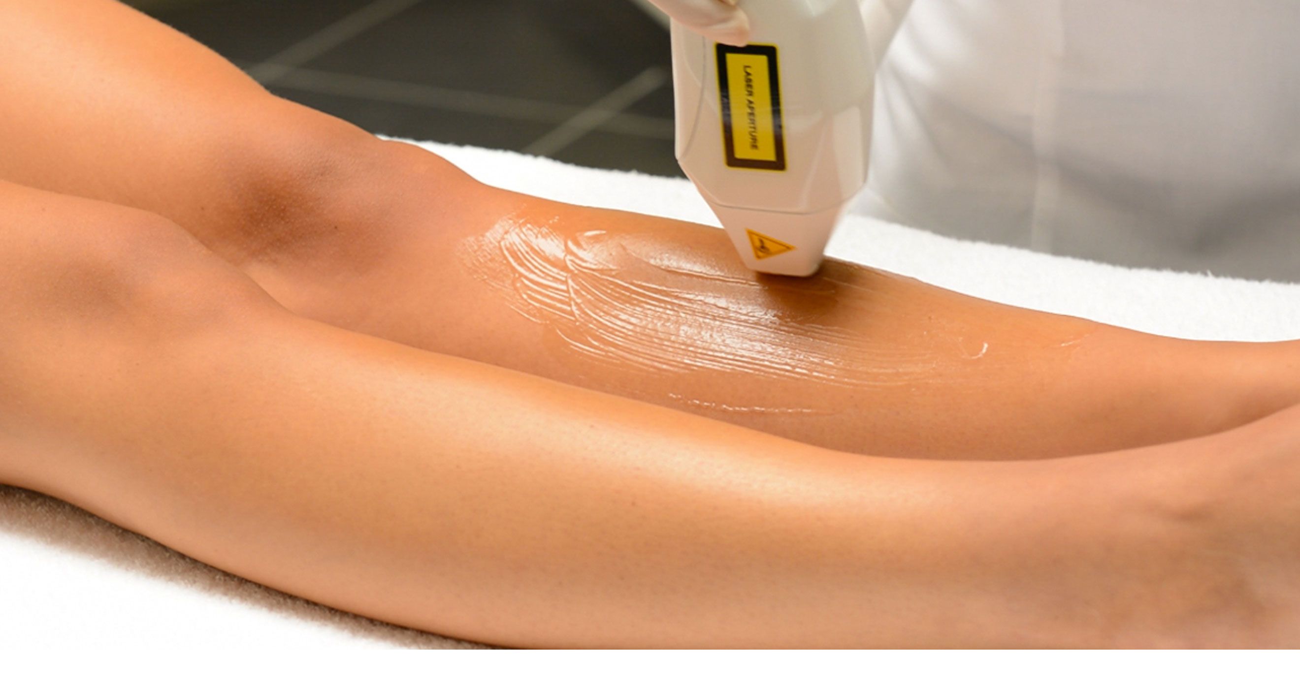 Discover Xlase Plus: Laser Hair Removal in Malta