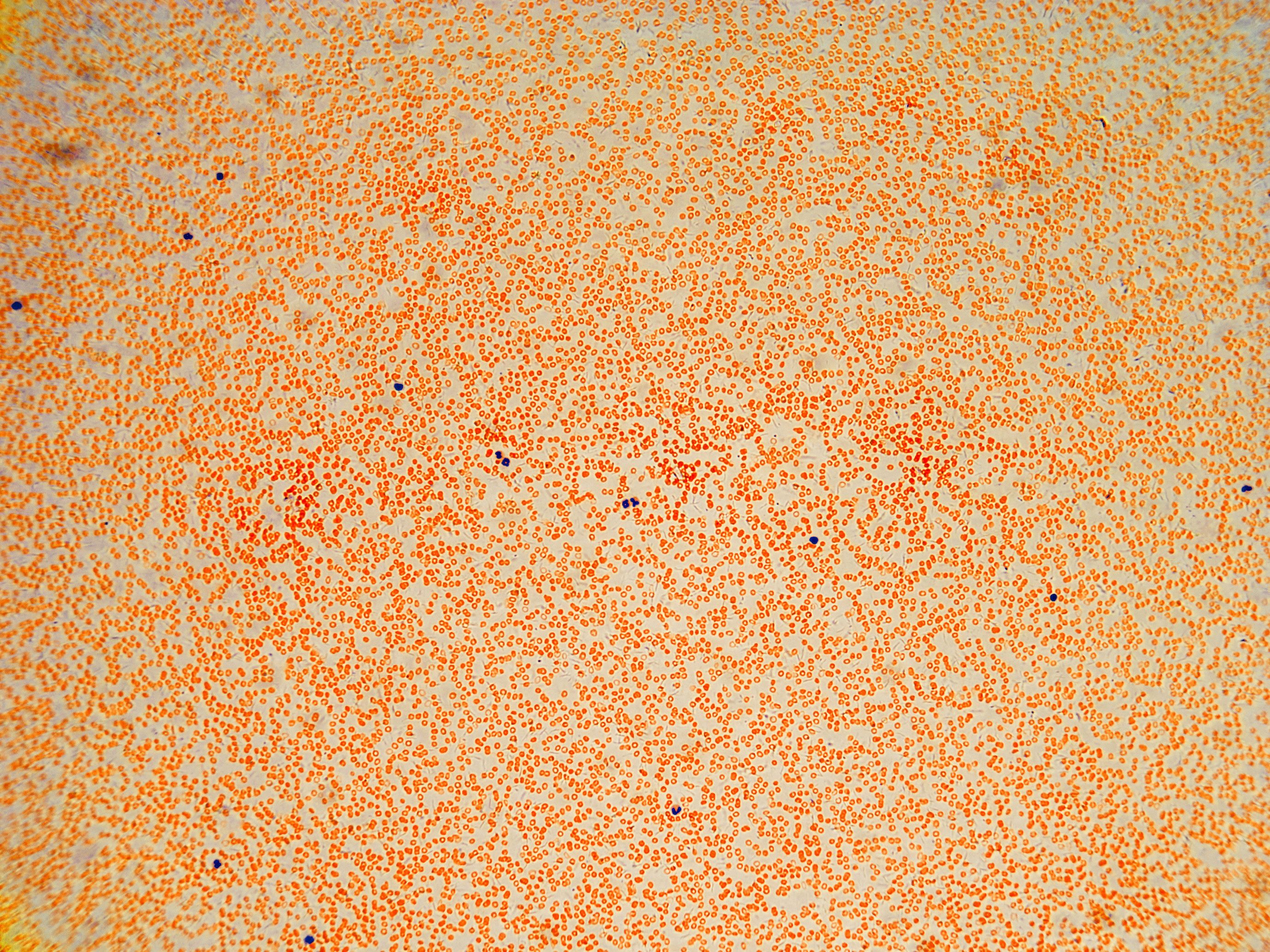 Light microscope micrograph of human blood smear at low magnification.