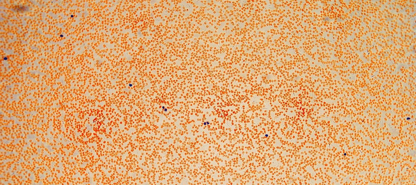 Light microscope micrograph of human blood smear at low magnification.