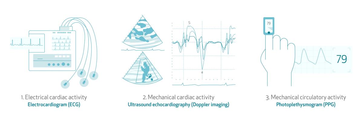 Is Pulse Rate The Same As Heart Rate Blog Empatica