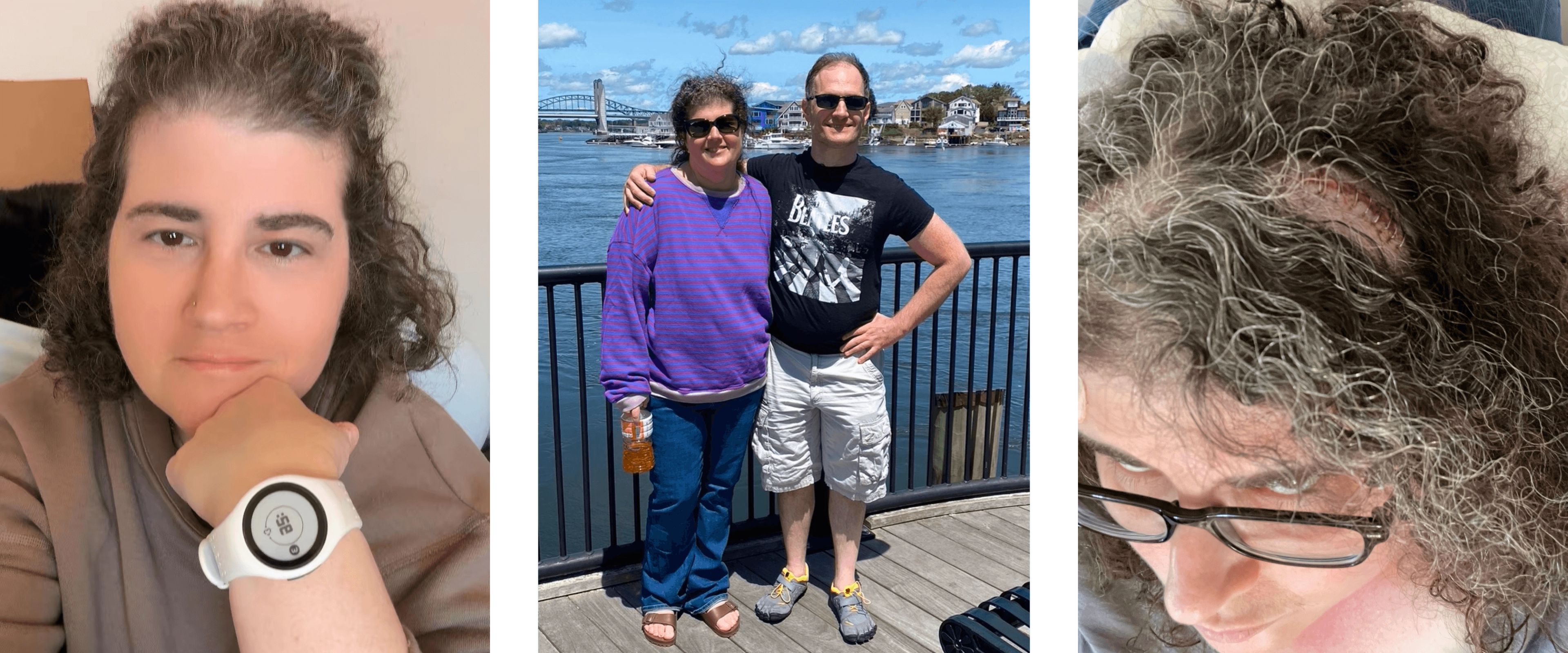 Brainwaves and Brushstrokes: Emily’s Epilepsy Journey