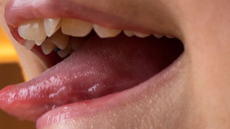 街角で声をかけて口内観察させてもらう カフェ店員 ひなちゃん ギャラリー 7