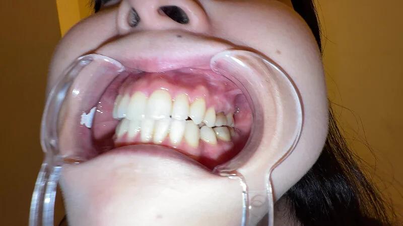 【個人撮影】横山夏希の喉チンコ触り＆肉厚舌を開口器で観察 ギャラリー 7