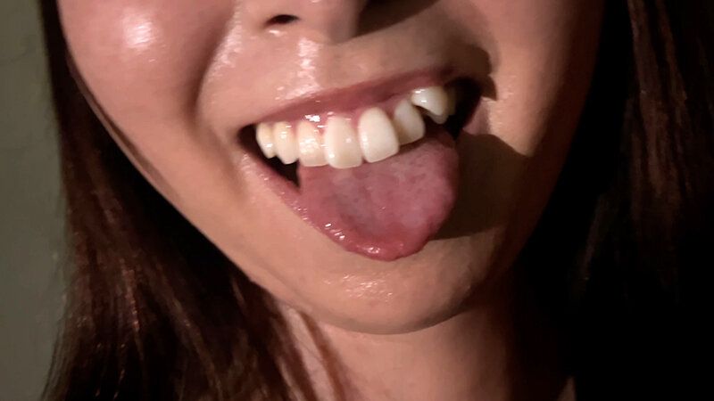 街角で声をかけて口内観察させてもらう 時計屋店員 みらいちゃん ギャラリー 11