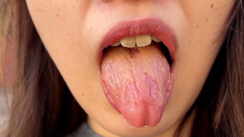 街角で声をかけて口内観察させてもらう 大学生 ゆゆちゃん ギャラリー 6