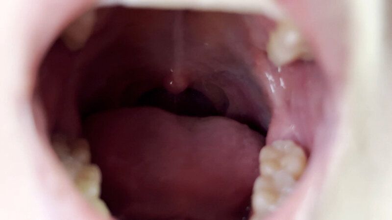 街角で声をかけて口内観察させてもらう 書店員 りかちゃん ギャラリー 3