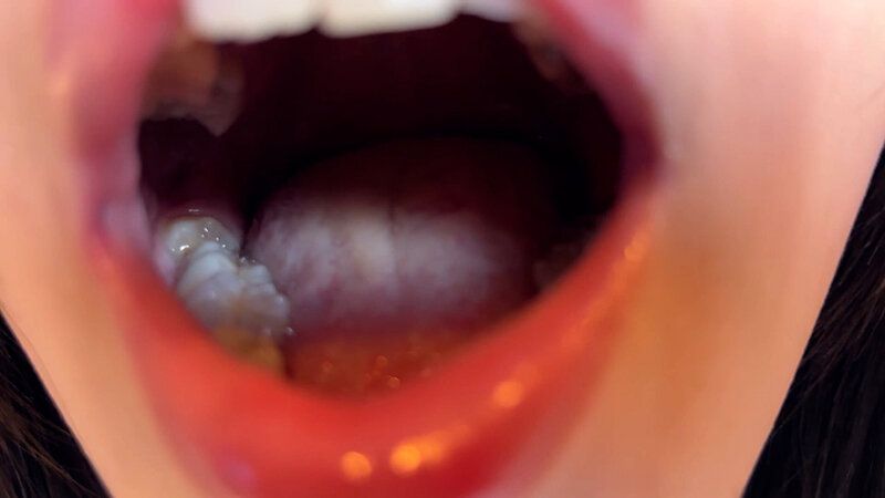 街角で声をかけて口内観察させてもらう 交渉上手な黒髪ギャル かなちゃん ギャラリー 5