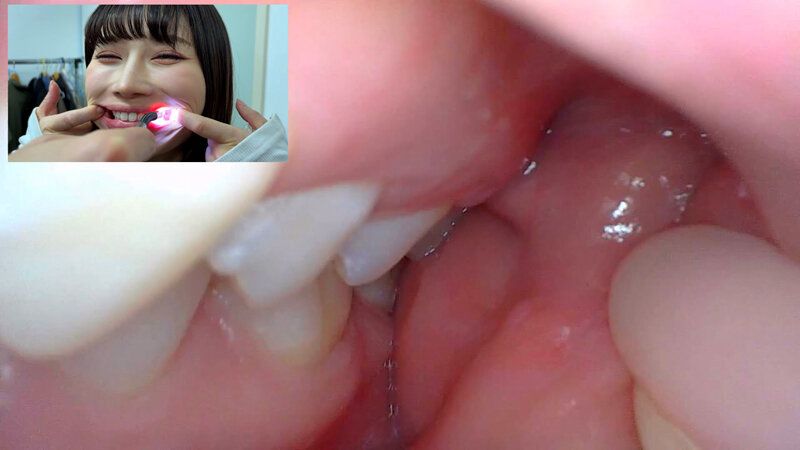 街角で声をかけて口内観察させてもらう アパレル関係 ひなみちゃん ギャラリー 18