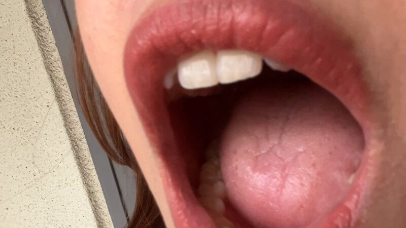 街角で声をかけて口内観察させてもらう 美容師 るかちゃん ギャラリー 4