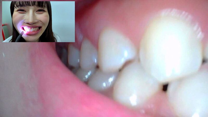 街角で声をかけて口内観察させてもらう アパレル関係 ひなみちゃん ギャラリー 14