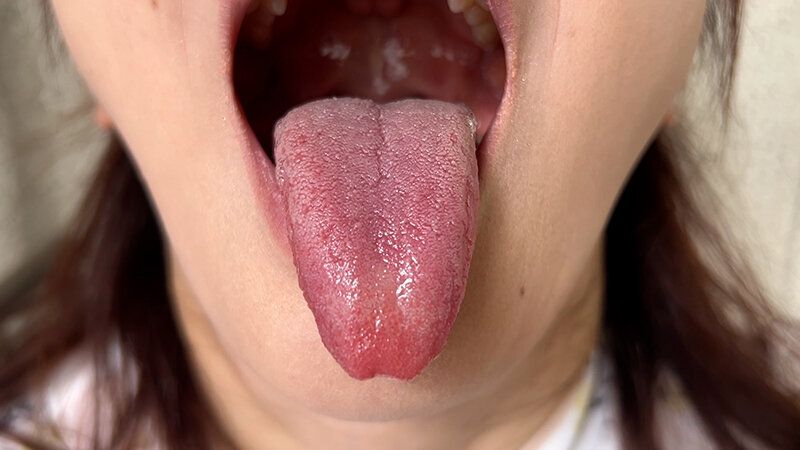 街角で声をかけて口内観察させてもらう スーパーのパート店員 まきさん ギャラリー 8