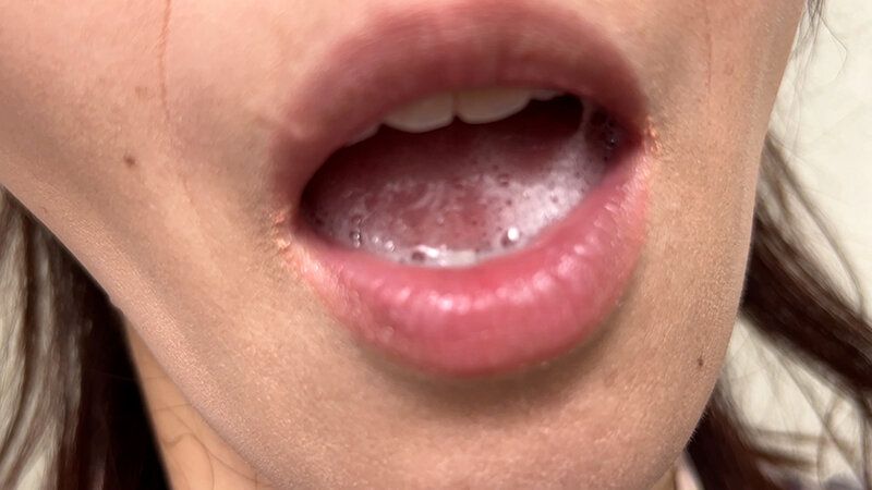 街角で声をかけて口内観察させてもらう スーパーのパート店員 まきさん ギャラリー 12