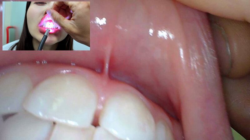 街角で声をかけて口内観察させてもらう アパレル関係 ひなみちゃん ギャラリー 16