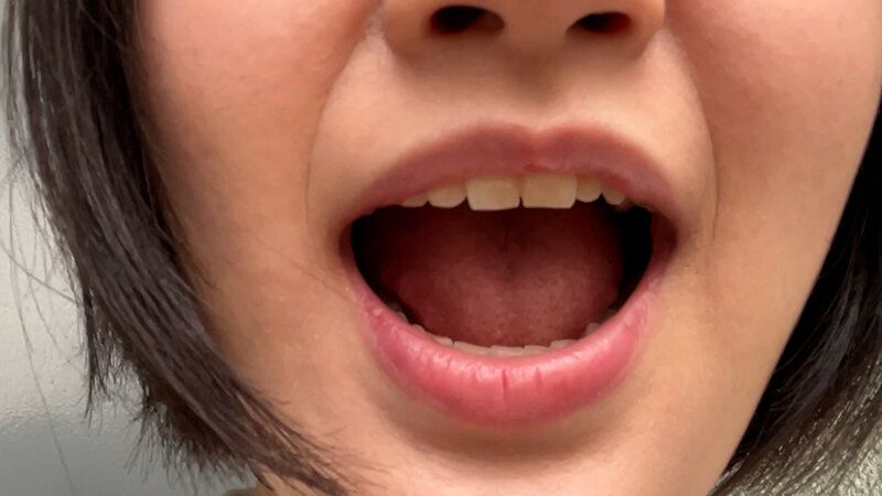 街角で声をかけて口内観察させてもらう 子供英語塾アルバイト のあちゃん ギャラリー 11