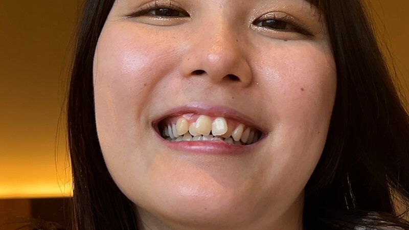 街角で声をかけて口内観察させてもらう カフェ店員 ひなちゃん ギャラリー 19