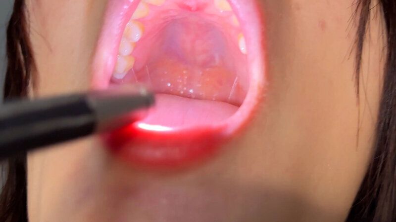 街角で声をかけて口内観察させてもらう 飲食店アルバイト みこちゃん ギャラリー 17