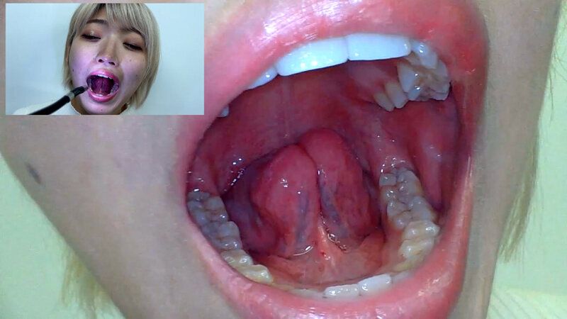 街角で声をかけて口内観察させてもらう 美容部員 はるのちゃん ギャラリー 19