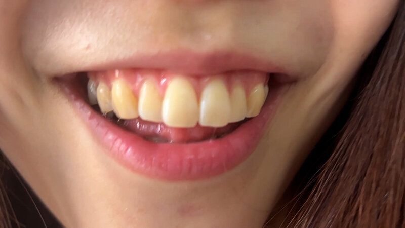 街角で声をかけて口内観察させてもらう アパレル店員 さゆりちゃん ギャラリー 16